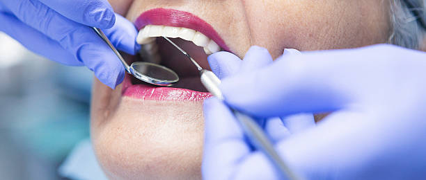 Best Emergency Tooth Extraction in Bloomfield, IN
